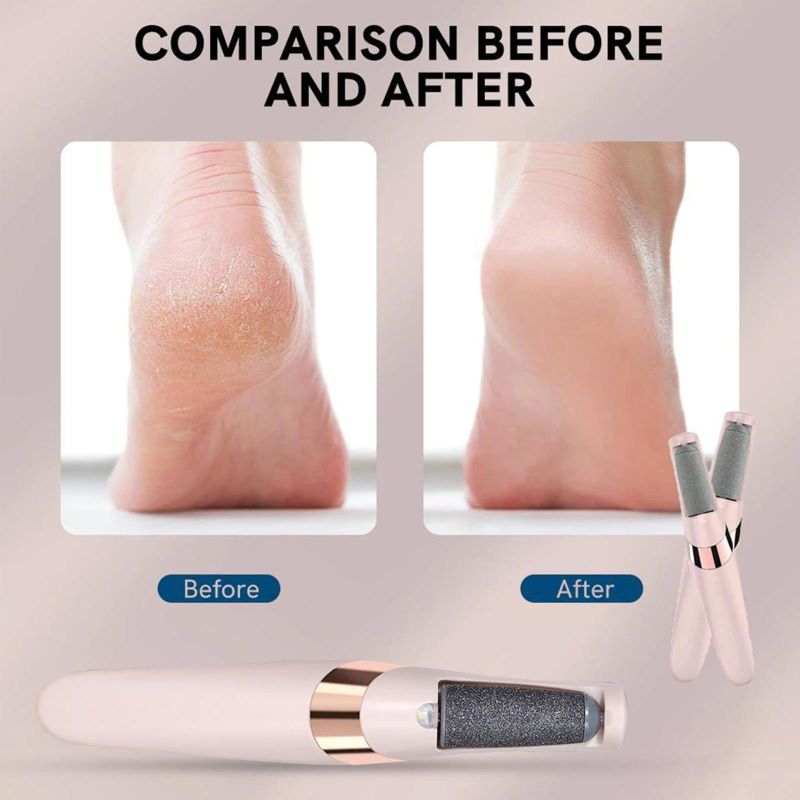 Electric Callus Remover with USB Charging