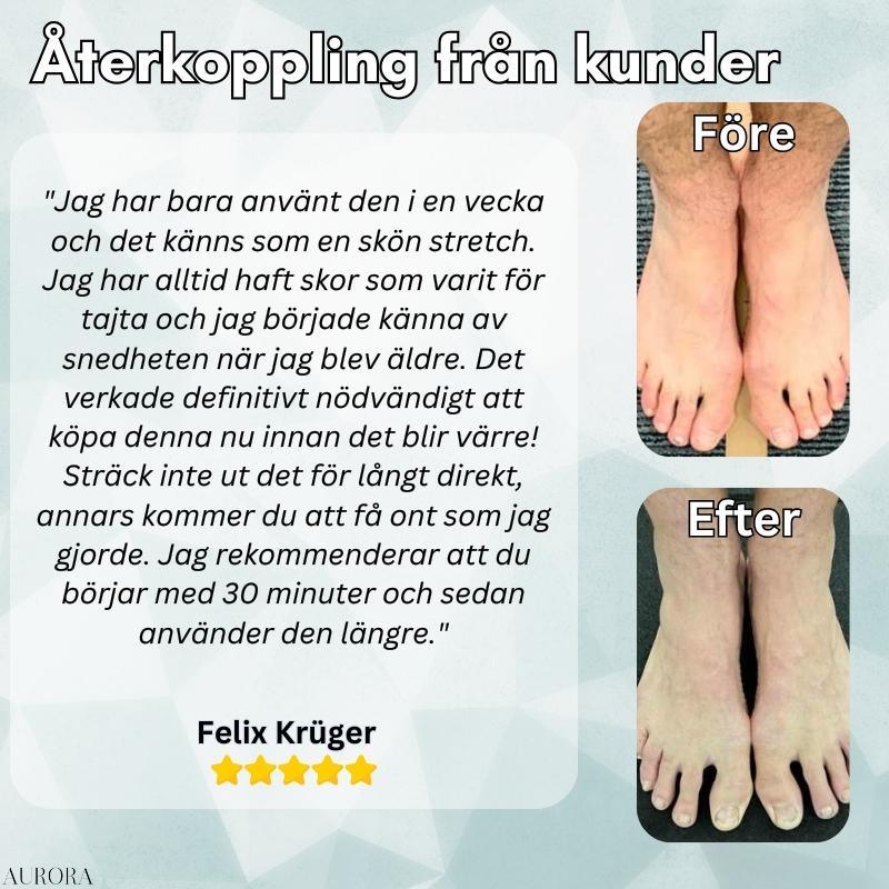 Hallux Valgus Corrector Splint