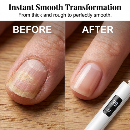 Electric Nail File with 4 Grinding Attachments