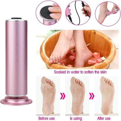 Electric Heel Remover for Healthy Feet