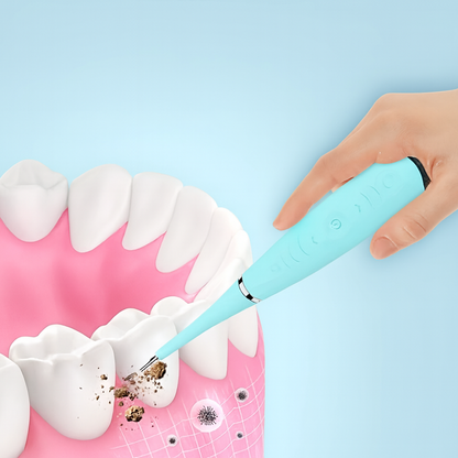 SonicSmile Ultrasonic Dental Cleaner