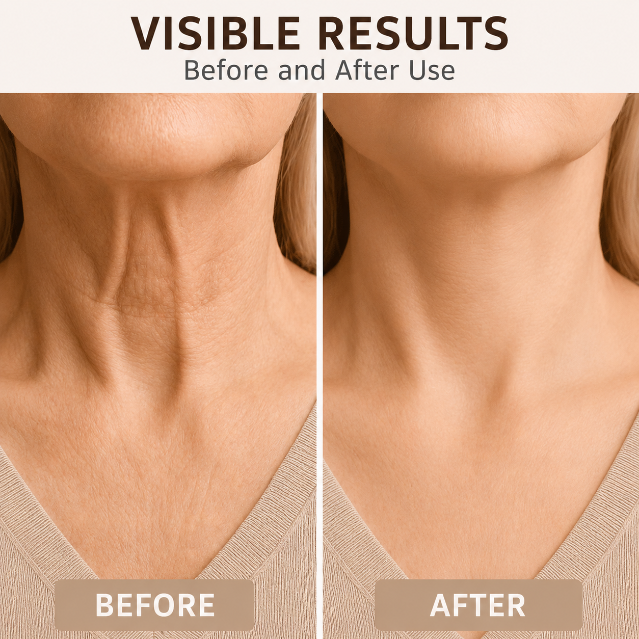 Neck Lifting Strips 20 Pack