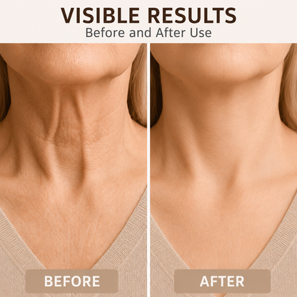 Neck Lifting Strips 20 Pack