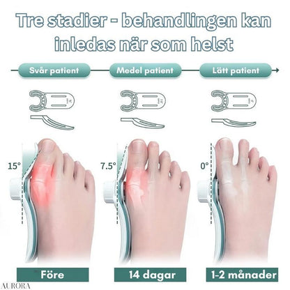 Hallux Valgus Corrector Splint