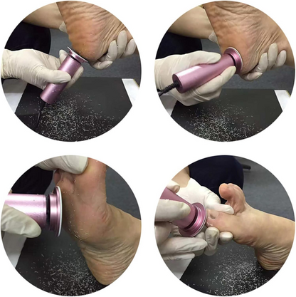 Electric Heel Remover for Healthy Feet