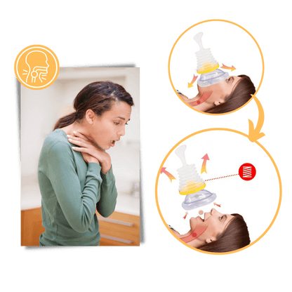 Anti-Choking Device – Emergency First Aid